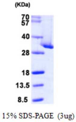 SDS-PAGE Recombinant Human CLIC4 His Protein