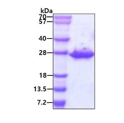 SDS-PAGE Recombinant Human CLPP Protein