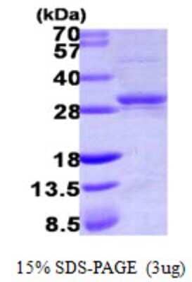 SDS-Page: Recombinant Human CMP kinase Protein [NBP1-51052] - 15 % SDS-PAGE (3ug)