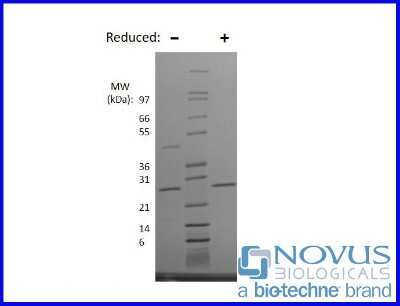 SDS-Page: Recombinant Human CNTF Animal-Free Protein [NBP2-76219] - 1 ug in each lane (-) non-reducing conditions and (+) reducing conditions in a 4-20% Tris-Glycine gel.