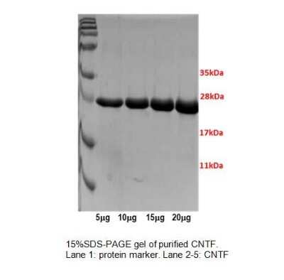 SDS-Page: Recombinant Human CNTF Protein [NBP1-99942]