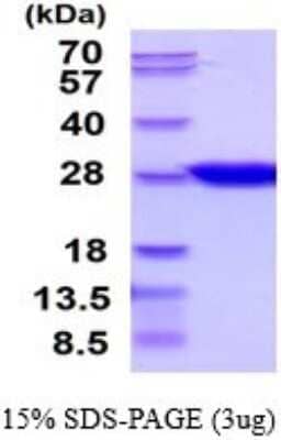 SDS-Page: Recombinant Human CNTF Protein [NBP2-53052] - 15% SDS-PAGE (3ug)