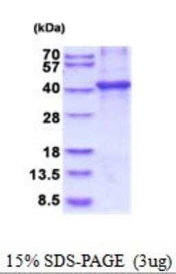 SDS-PAGE Recombinant Human CNTFR His Protein