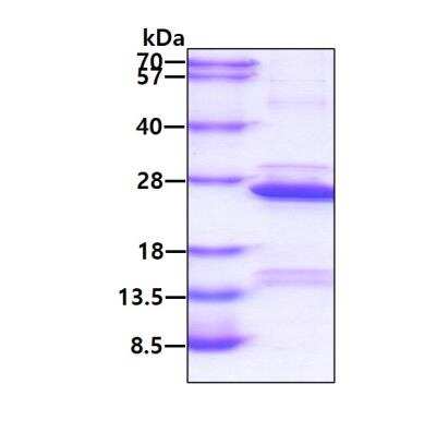 SDS-Page: Recombinant Human COMMD1 Protein [NBP1-50846] - 3ug by SDS-PAGE under reducing condition and visualized by coomassie blue stain.