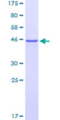 SDS-Page: Recombinant Human COMMD3 Protein [H00023412-P02] - 12.5% SDS-PAGE Stained with Coomassie Blue.