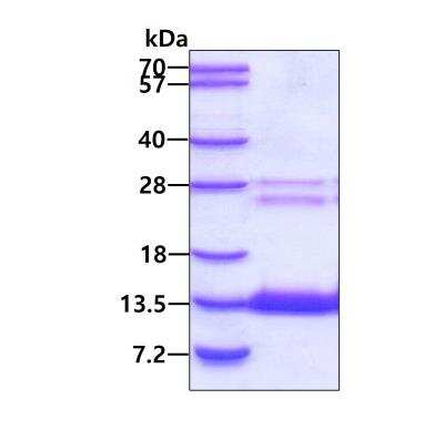 SDS-Page: Recombinant Human COMMD6 His Protein [NBP2-51781] - 3ug by SDS-PAGE under reducing condition and visualized by coomassie blue stain.