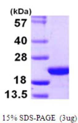 SDS-Page: Recombinant Human COPZ1 Protein [NBP1-72296] - 15% SDS-PAGE (3ug)