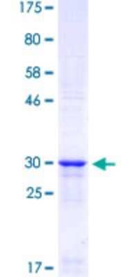 SDS-Page: Recombinant Human COUP-TF II/NR2F2 Protein [H00007026-Q02] - 12.5% SDS-PAGE Stained with Coomassie Blue.