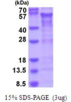 SDS-Page: Recombinant Human CREB3L2 Protein [NBP2-51927]