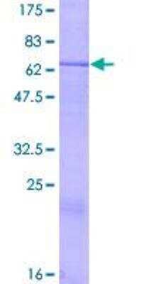 SDS-Page: Recombinant Human CRLF1 Protein [H00009244-P01] - 12.5% SDS-PAGE Stained with Coomassie Blue.