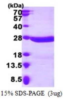 SDS-Page: Recombinant Human CRYBA4 Protein [NBP1-72411] - 15% SDS-PAGE (3ug)