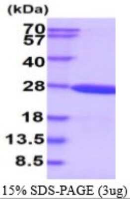 SDS-Page: Recombinant Human CRYGS Protein [NBP1-72447] - 15% SDS-PAGE (3ug)