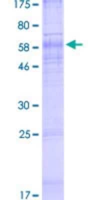 SDS-PAGE Recombinant Human CTNS GST (N-Term) Protein