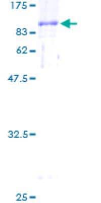 Unknown Recombinant Human CTP synthase GST (N-Term) Protein