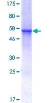 SDS-PAGE Recombinant Human CTRP7 GST (N-Term) Protein