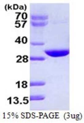 SDS-Page: Recombinant Human CUTC Protein [NBP1-72425] - 15% SDS-PAGE (3ug)
