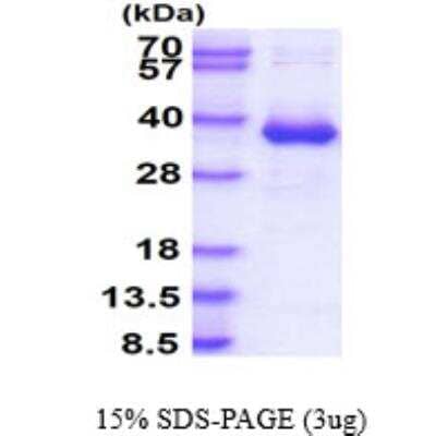 SDS-PAGE Recombinant Human CYB5R3 His Protein