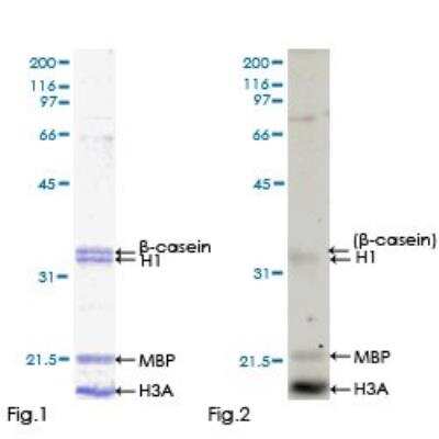Functional: Recombinant Human CaMKI gamma Protein [H00057172-P01]