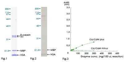 Functional: Recombinant Human CaMKII beta Protein [H00000816-P01]