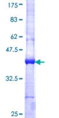 SDS-Page: Recombinant Human CaMKII beta Protein [H00000816-Q01] - 12.5% SDS-PAGE Stained with Coomassie Blue.