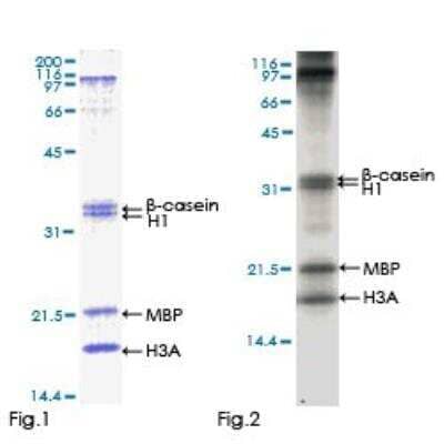 Functional: Recombinant Human CaMKV Protein [H00079012-P01]