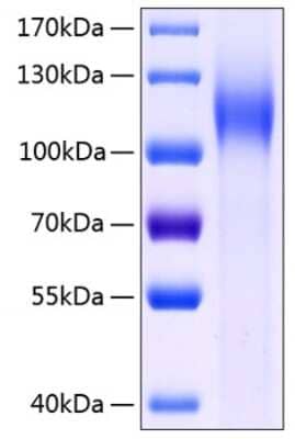 SDS-PAGE Recombinant Human Cadherin-17 His (C-Term) Protein