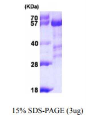 Unknown Recombinant Human Calcineurin A His Protein