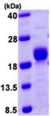 SDS-Page: Recombinant Human Calcineurin B Protein [NBP1-78797] - 15% SDS-PAGE (3 ug).