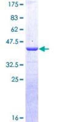 SDS-PAGE Recombinant Human Calcitonin GST (N-Term) Protein