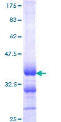 SDS-PAGE Recombinant Human Calcitonin GST (N-Term) Protein