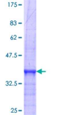 SDS-Page: Recombinant Human Calcitonin R Protein [H00000799-Q01] - 12.5% SDS-PAGE Stained with Coomassie Blue.