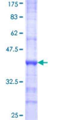 SDS-Page: Recombinant Human Calcium-sensing R/CaSR Protein [H00000846-Q01] - 12.5% SDS-PAGE Stained with Coomassie Blue.