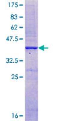 SDS-Page: Recombinant Human Calcium-sensing R/CaSR Protein [H00000846-Q02] - 12.5% SDS-PAGE Stained with Coomassie Blue.