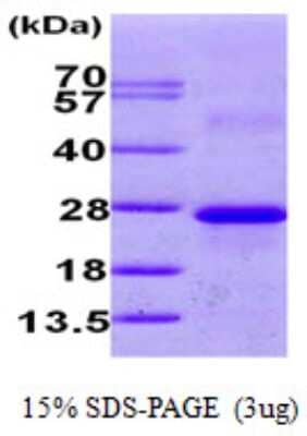 SDS-PAGE Recombinant Human Calneuron 1 His Protein