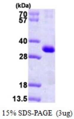 SDS-PAGE Recombinant Human Calsenilin His Protein