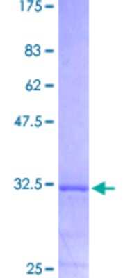 SDS-Page: Recombinant Human Cannabinoid R2/CB2/CNR2 Protein [H00001269-Q01] - 12.5% SDS-PAGE Stained with Coomassie Blue.