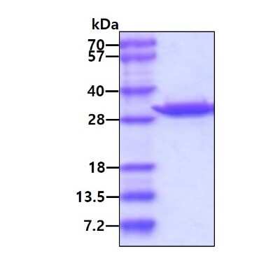 SDS-Page: Recombinant Human Carbonic Anhydrase II/CA2 Protein [NBC1-28002] - 3ug by SDS-PAGE under reducing condition and visualized by coomassie blue stain.