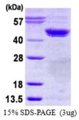 SDS-Page: Recombinant Human Casein Kinase 2 alpha Protein [NBP1-99066] - 15% SDS-PAGE (3ug)