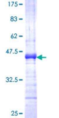 SDS-Page: Recombinant Human Caspase 5 Protein [H00000838-Q01] - 12.5% SDS-PAGE Stained with Coomassie Blue.