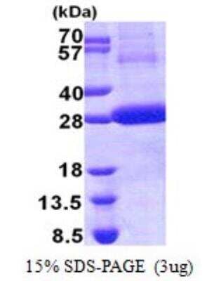 SDS-Page: Recombinant Human Cathepsin F Protein [NBP2-22739]