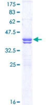 SDS-Page: Recombinant Human Cav1.2 Protein [H00000775-Q01] - 12.5% SDS-PAGE Stained with Coomassie Blue.