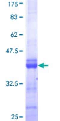SDS-Page: Recombinant Human Cav1.4 Protein [H00000778-Q01] - 12.5% SDS-PAGE Stained with Coomassie Blue.