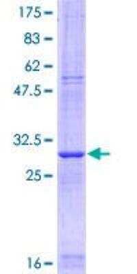 SDS-Page: Recombinant Human Claudin-5 Protein [H00007122-Q01] - 12.5% SDS-PAGE Stained with Coomassie Blue