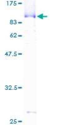 SDS-PAGE Recombinant Human Cleavage stimulation factor 2 GST (N-Term) Protein