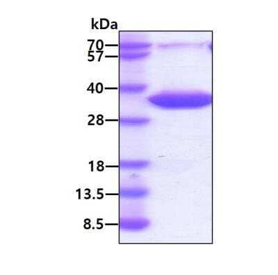 Recombinant Human Coagulation Factor III/Tissue Factor Protein [NBP2-22785] - 3ug by SDS-PAGE under reducing condition and visualized by coomassie blue stain.