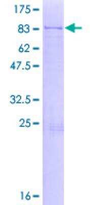 SDS-Page: Recombinant Human Coatomer Subunit Delta Protein [H00000372-P01] - 12.5% SDS-PAGE Stained with Coomassie Blue.