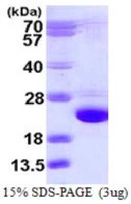 SDS-PAGE Recombinant Human Cofilin 2 His Protein