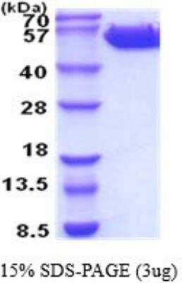 SDS-Page: Recombinant Human Common beta Chain Protein [NBP2-52244] - 15% SDS Page (3 ug)