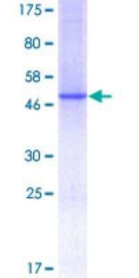 SDS-PAGE Recombinant Human Complement Component C1qC GST (N-Term) Protein