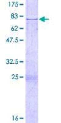 SDS-Page: Recombinant Human Complement Factor H Protein [H00003075-P03] - 12.5% SDS-PAGE Stained with Coomassie Blue.